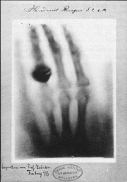 Premier cliché radiographique (Röntgen,1895)