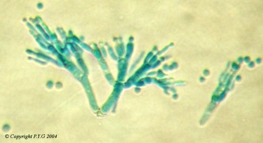 Penicillium roqueforti : image par microscopie. Ce champignon de la famille des Penicillium est à l'origine du « bleu » des fromages de roquefort.
