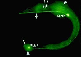 Les deux récepteurs neuronaux du toucher du ver C. elegans ALMR et PLMR marqués et tracés grâce à la GFP.