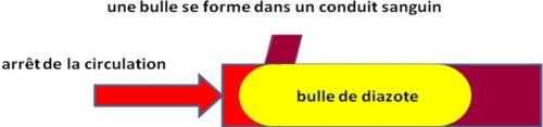 La bulle de diazote formée au sein d’un tissu entrave la libre circulation du sang. C’est « l’accident de décompression »