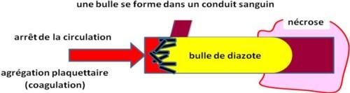 L’organisme réagit contre la présence du corps étranger. C’est la « maladie de décompression »