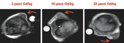 IRM de souris traitées par le traceur vectorisé par le résidu folate, à différentes doses. En dessous de 10 μmol par kg, l’intensité du signal n’est pas suffisante. À 30 μmol par kg, l’intensité du signal est rehaussée, mais aucune différence de sélectivité n’est observée entre les traceurs avec ou sans résidu folate greffé.