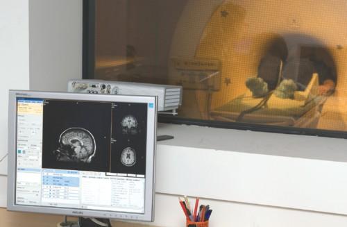 On voit sur l’écran d’un ordinateur l’image anatomique d’un cerveau acquise avec un appareil d’IRM d’un champ magnétique de 3 Teslas, et dans lequel est installé un patient.