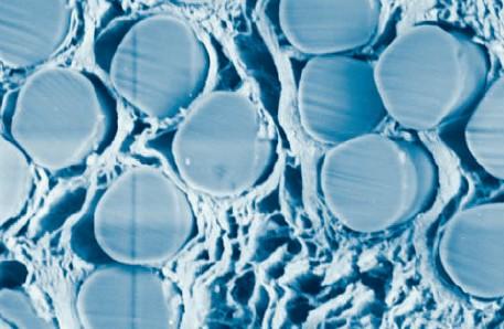 Ligaments artificiels, dits bioactifs, vus au microscope.