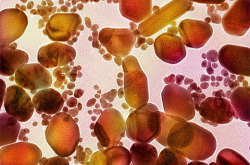 visuel nanoparticules or SEM