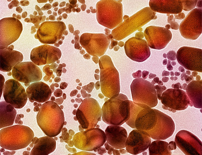 visuel nanoparticules or SEM